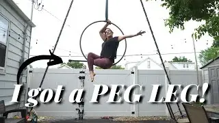 Above Knee Amputee Gets A Peg Leg!