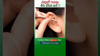 Chevilo 👂👂👂 Gubili Mottham Clean Avvalante ? 🦻🦻🦻Simple Ga Ilaa Cheyandi 
