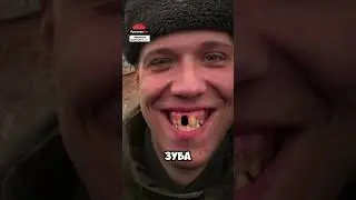 Парень вырвал зуб, чтобы не служить в армии #shorts