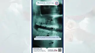 Crooked Teeth and Your Health 🦷 What You Need to Know!
