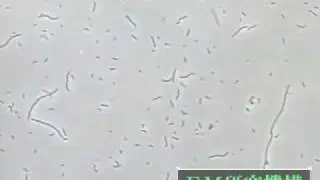 Lactic Acid Bacteria.wmv