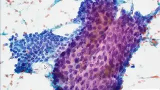 EUS FNA normal duodenum