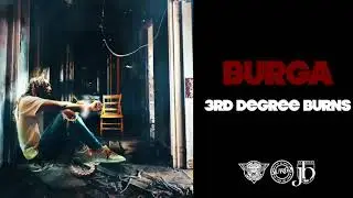 Burga - 3rd Degree Burns (Deluxe) [Official Audio]