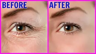 How To Remove 