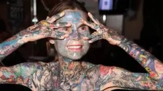 Top 16 People With Extra Body Parts