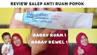 Selamat tinggal RUAM POPOK !! | Review Jujur salep anti iritasi