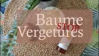 STOP VERGETURES baume aux huiles précieuses - L'Arômeuse