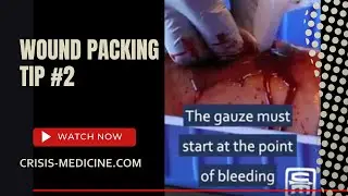 Wound Packing tip #2