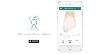 GC Restorative Dentistry - руководство по выбору материала для успешной реставрации