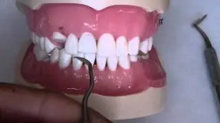 Composite Finishing - Flash Removal