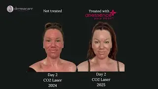 Kaeli's CO2 Refresh with Ariessence