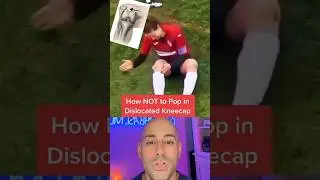 How NOT To Treat Kneecap Dislocation 