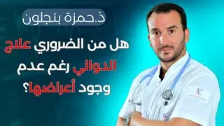 هل من الضروري علاج الدوالي حتى في حالة عدم وجود أعراضها؟