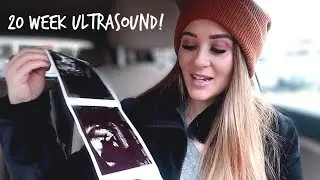 I WAS WRONG! 20 WEEK ULTRASOUND APPOINTMENT! | Liza Adele