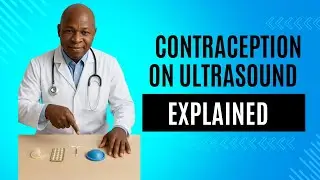Contraception Explained