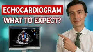Cardiologist explains Echocardiograms