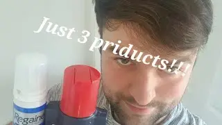 How to prevent hair loss!! (men only) real #foryou