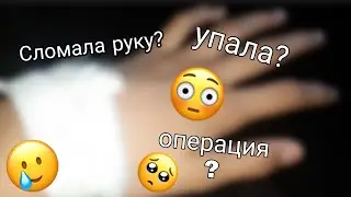 Сломала руку😱Сшили мою руку🤯😱😰
