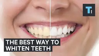 DentolanFresh Breath Review #teeth