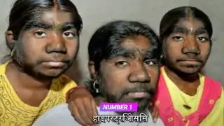 सावधान -  बच्चों को यह नहीं देखना चाहिए |Top 5 बिमारी जो वैज्ञानिक और डॉक्टर को सदमे मे छोड़ दिया