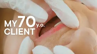 My 70 Years Old Client | PMU