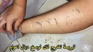 جربي هاد تبريمة الملكية وغادي تشوفي الوسوخات لي عمرها خرجات ليك كلشي غادي يتصدم فيك