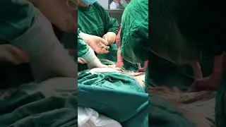 Welcome baby to nEw world  || C-section || educational video
