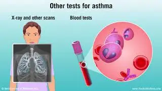 Diagnosing Asthma: Mild, Moderate and Severe
