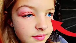 🫢Her Eye! | Austria🇦🇹 8