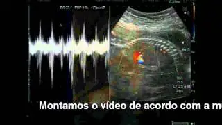 Filmagem de Parto em NIteroi e Rio de Janeiro