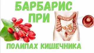 Барбарис полезные свойства при полипах кишечника - аптека трав Фито