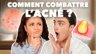 COMBATTRE L’ACNÉ : Quelles solutions pour en venir à bout ? (Roaccutane & Skincare Routine)