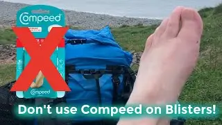 ED SLOT - ITS ALL ABOUT BLISTERS | WHEN NOT TO USE COMPEED!