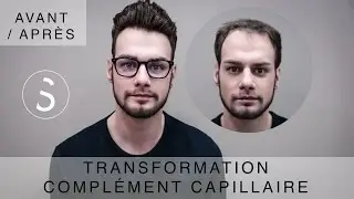 ► Complément capillaire - Transformation - BYSIX