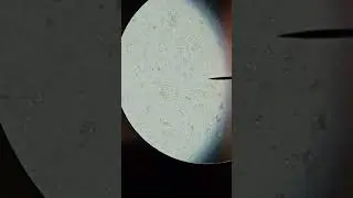 Pond water under magnification.  #biology #microbiology #science   #amazing