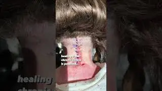 Keep Believing Healing Is Possible