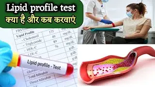 lipid profile test kya hota hai | lipid profile test in hindi | lipid profile test kaise hota hai