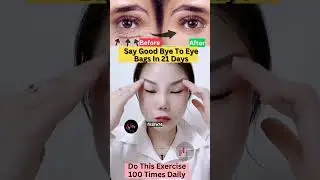 Say Good Bye To Eye Bags | Eye Care Yoga #eyelift #eyeexercise #yoga #faceyoga #fitness #shorts