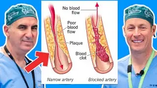 Peripheral Arterial Disease: Symptoms, Risks, and Treatments