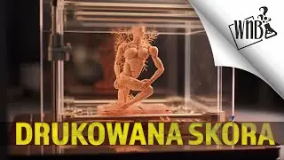 Kiedy wydrukujemy sobie nową skórę?