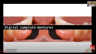 Digital Dentures By Dr Foteini Toulouse