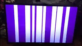 Эпилепсия