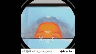 Cure tinnitus reverse hearing loss cure middle and inner ear issues Apr 3, 2023 9:05 PM