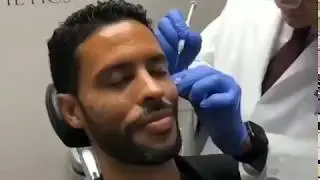 Treating  Acne Scars