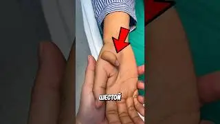 Опасная Болезнь Рук! 😱