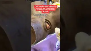 #OBGYN