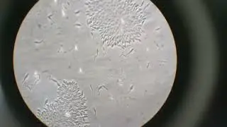✅Epimastigotes de Trypanosoma cruzi en cultivo celular