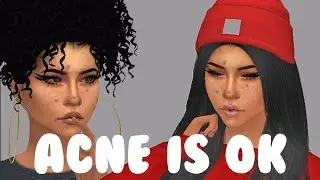 Sims 4 Create A Sim | Acne Is Ok