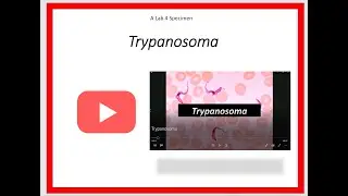 Trypanosoma