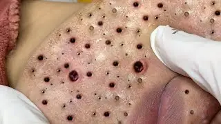 تلميع وتنظيف الجلد الطبيعي المدور 1413610